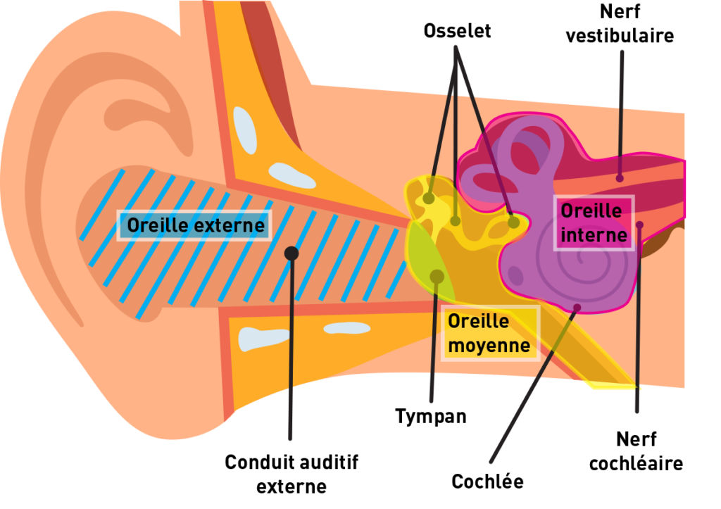 Schéma des troubles de l'audition